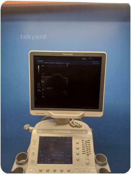 TOSHIBA APLIO 500 ULTRASOUND SYSTEM % (271951) DIAGNOSTIC ULTRASOUND MACHINES FOR SALE