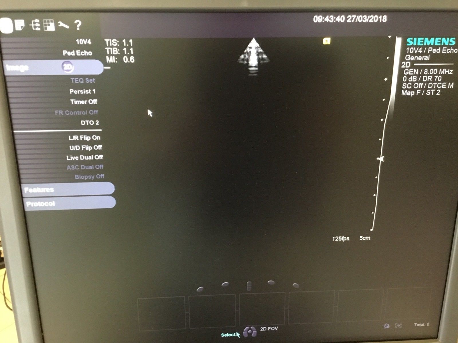 Siemens Acuson S2000 Cardiac Ultrasound system with 3 transducers DIAGNOSTIC ULTRASOUND MACHINES FOR SALE