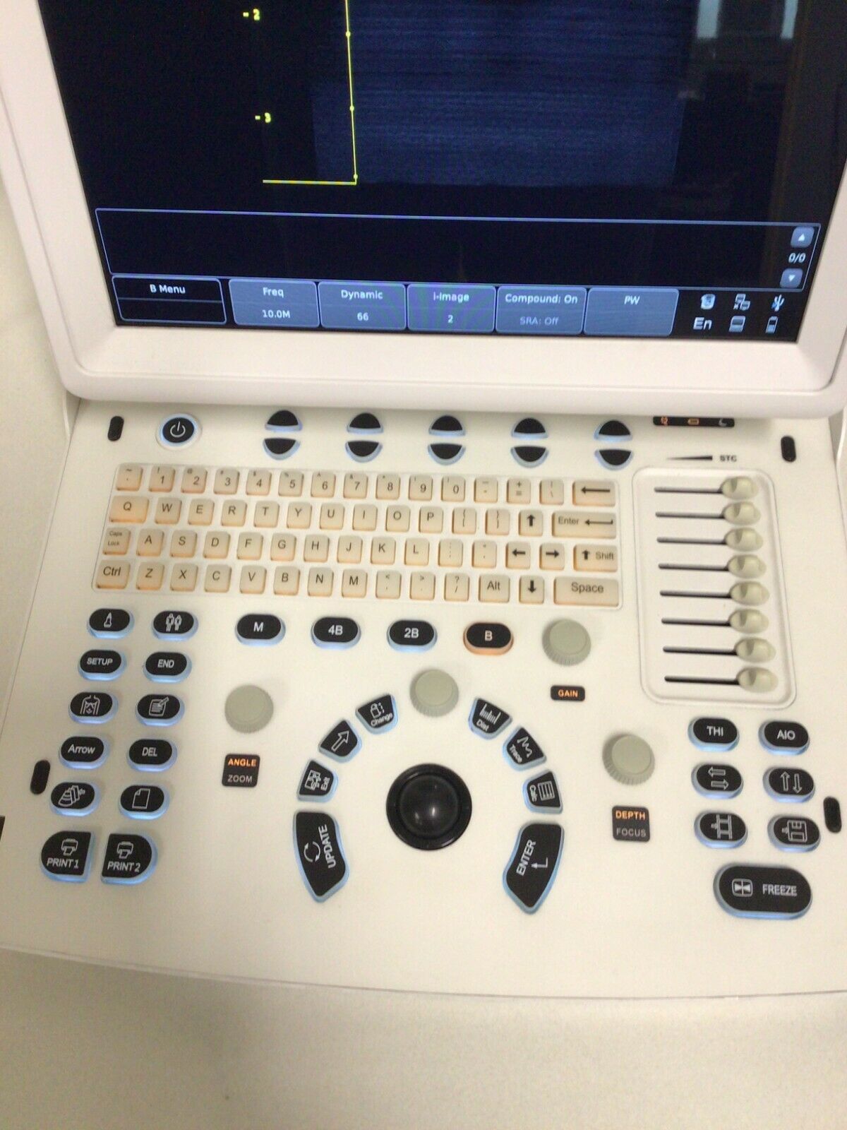 Chison Eco 3 Ultrasound w/ Probe and Carrying Case DIAGNOSTIC ULTRASOUND MACHINES FOR SALE