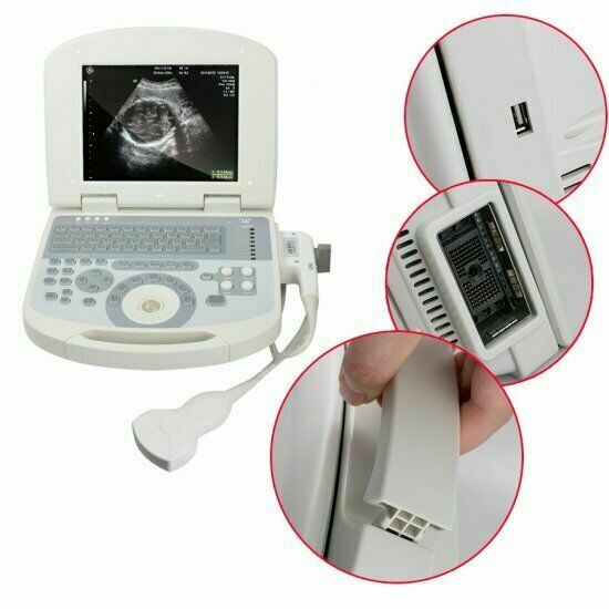 Portable Digital Laptop Medical Ultrasound Scanner+3.5 Convex probe high-quality DIAGNOSTIC ULTRASOUND MACHINES FOR SALE