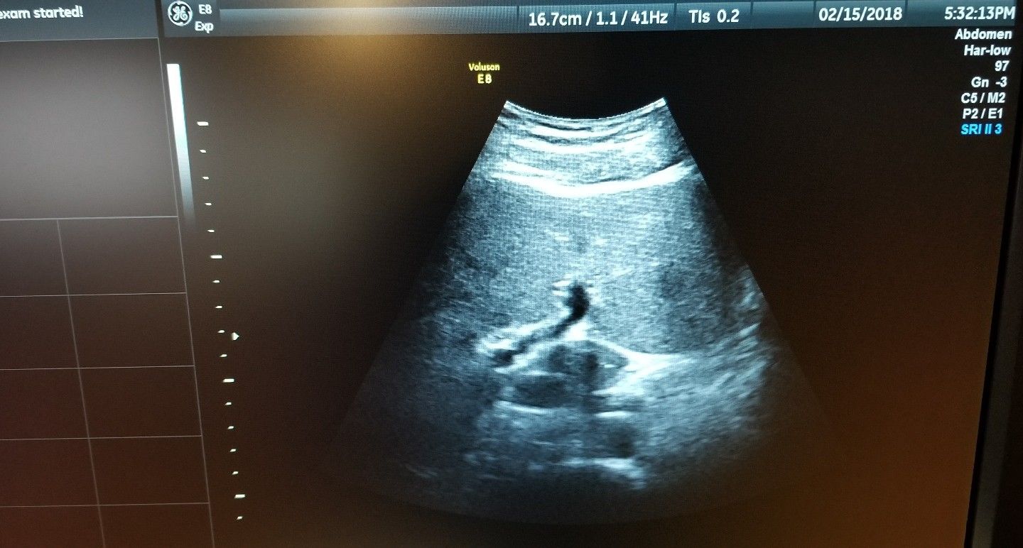 GE Health Care  4C-D