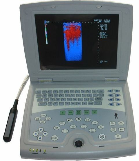 Veterinary Laptop - Animal Ultrasound Scanner - Bovine, Equine KeeboMed KX5000KV DIAGNOSTIC ULTRASOUND MACHINES FOR SALE