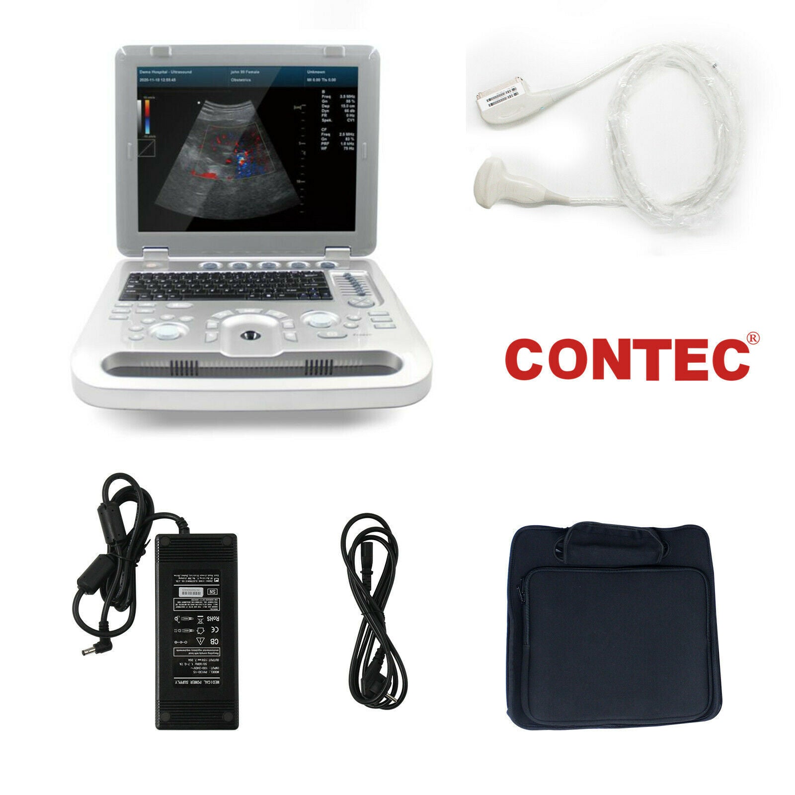 Portable Ultrasound Scanner Color Doppler Muscle Blood Vessel CW Optional 3D/ 4D DIAGNOSTIC ULTRASOUND MACHINES FOR SALE