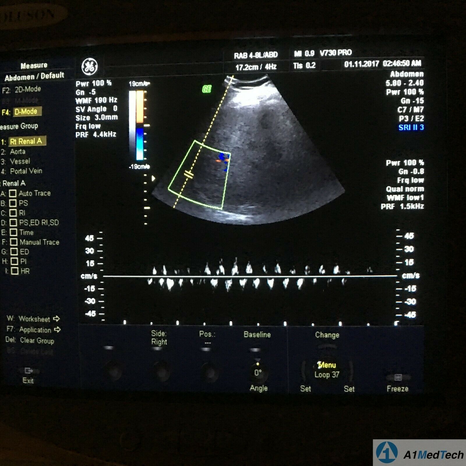GE RAB4-8L Volume Ultrasound Probe DIAGNOSTIC ULTRASOUND MACHINES FOR SALE