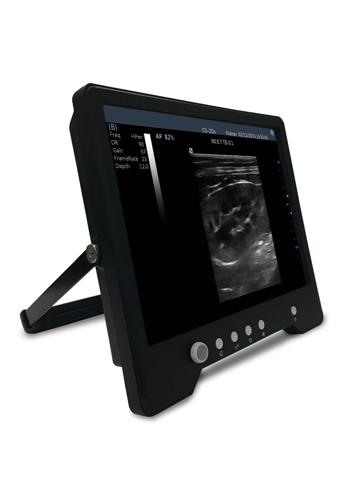 Veterinary TouchScreen Ultrasound&Micro-Convex Probe for Small Animals, KeeboMed DIAGNOSTIC ULTRASOUND MACHINES FOR SALE