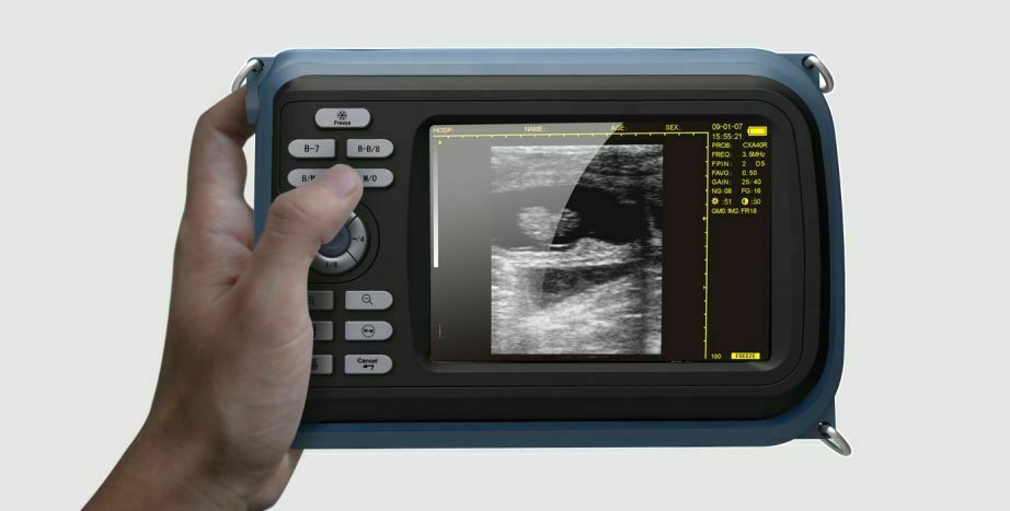 5.5" Handheld Digital Ultrasound Scanner LCD HandScan 3.5MHz Convex Probe  Case DIAGNOSTIC ULTRASOUND MACHINES FOR SALE