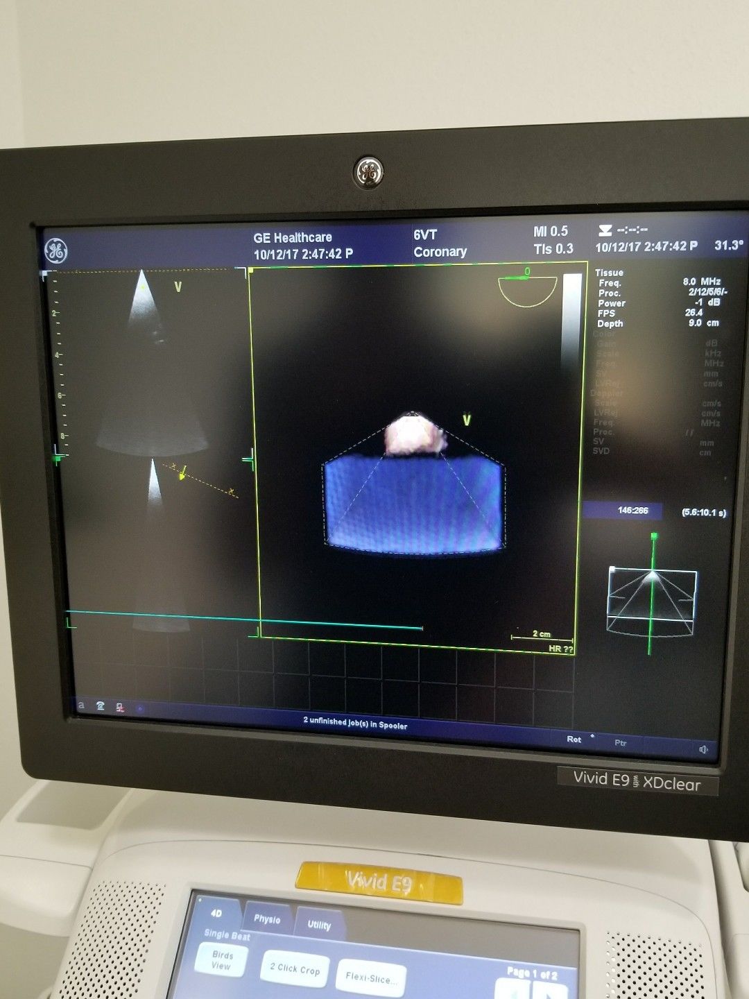 GE 6VT-D Ultrasound Probe / Transducer Demo Condition DIAGNOSTIC ULTRASOUND MACHINES FOR SALE