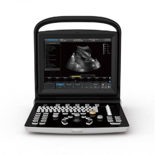 CHISON ECO-3 ULTRASOUND + 2 TRANSDUCERS INCLUDED DIAGNOSTIC ULTRASOUND MACHINES FOR SALE