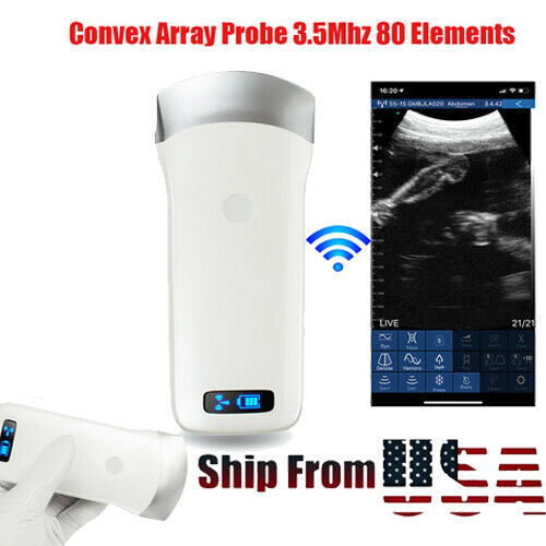 Portable WIFI Wireless Ultrasound Scanner Machine Convex Probe 3.5Mhz Medical CE DIAGNOSTIC ULTRASOUND MACHINES FOR SALE