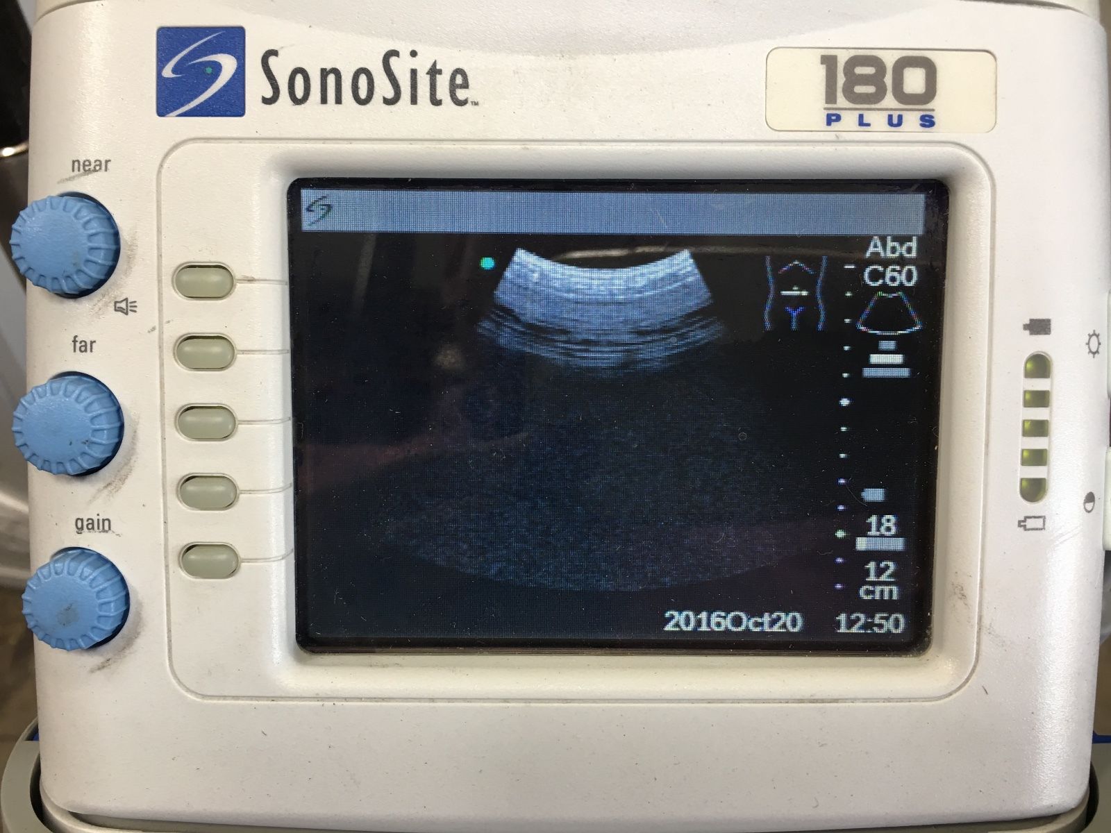 SonoSite 180 Plus Ultrasound System DIAGNOSTIC ULTRASOUND MACHINES FOR SALE