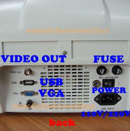 Portable Machine Digital Ultrasound Scanner Transvaginal Probe -EXT 3D Software 190891982230 DIAGNOSTIC ULTRASOUND MACHINES FOR SALE