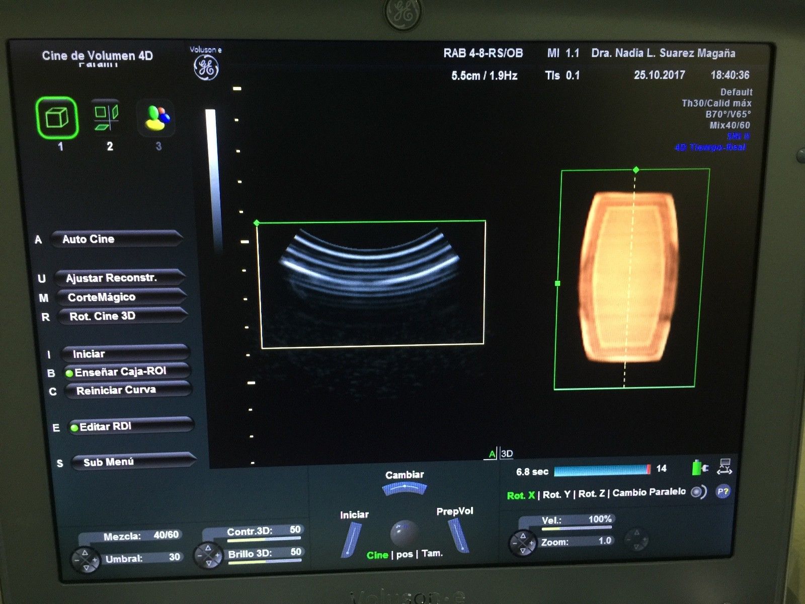 GE RAB4-8-RS 4D CONVEX PROBE FOR VOLUSON i/e/S6/S8 DIAGNOSTIC ULTRASOUND MACHINES FOR SALE