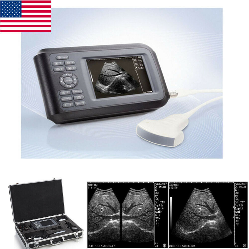 Handheld Ultrasound Scanner/Machine Convex Probe Abdominal Ultrasound Human Use DIAGNOSTIC ULTRASOUND MACHINES FOR SALE