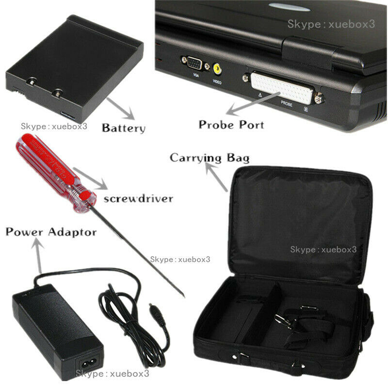 Digital Portable Ultrasound Machine Laptop Scanner with Convex Probe,US shipping 6945040100362 DIAGNOSTIC ULTRASOUND MACHINES FOR SALE