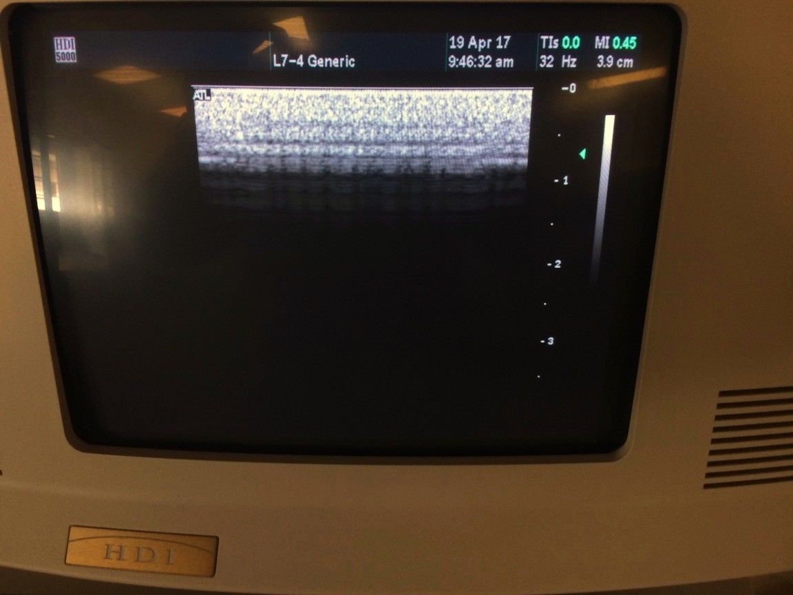 ATL HDI 5000 CV Ultrasound w/ 3 Probes DIAGNOSTIC ULTRASOUND MACHINES FOR SALE