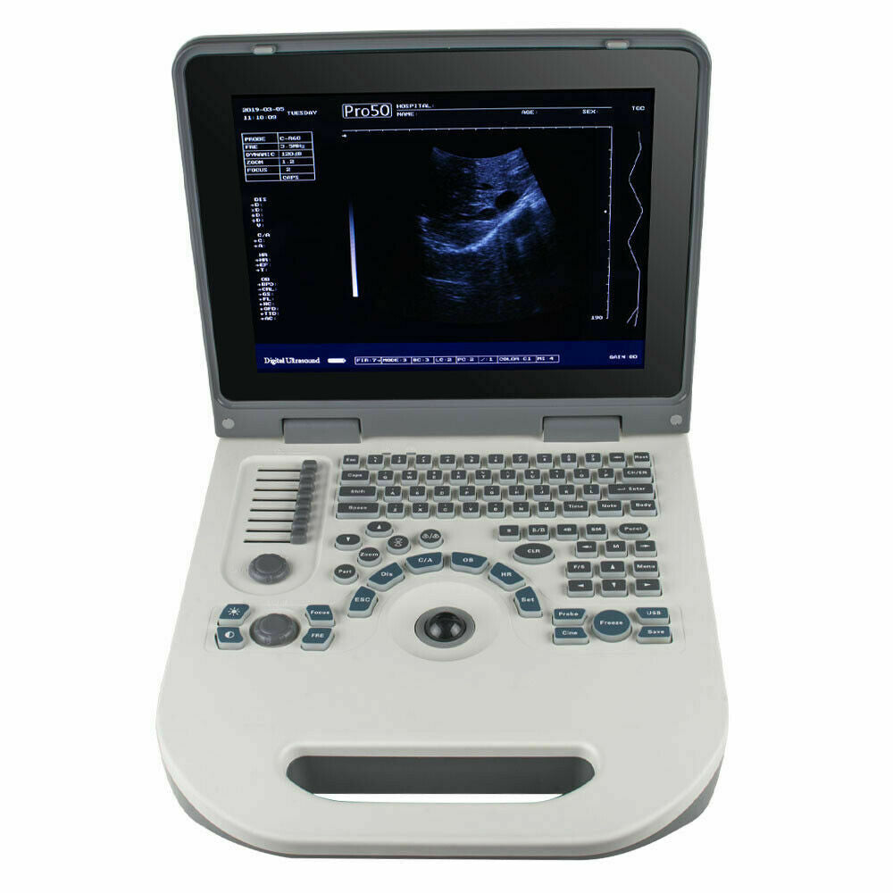 USA Full Digital Ultrasound Scanner Ultrasonic MachineDisgnos Convex Probe 3D CE DIAGNOSTIC ULTRASOUND MACHINES FOR SALE