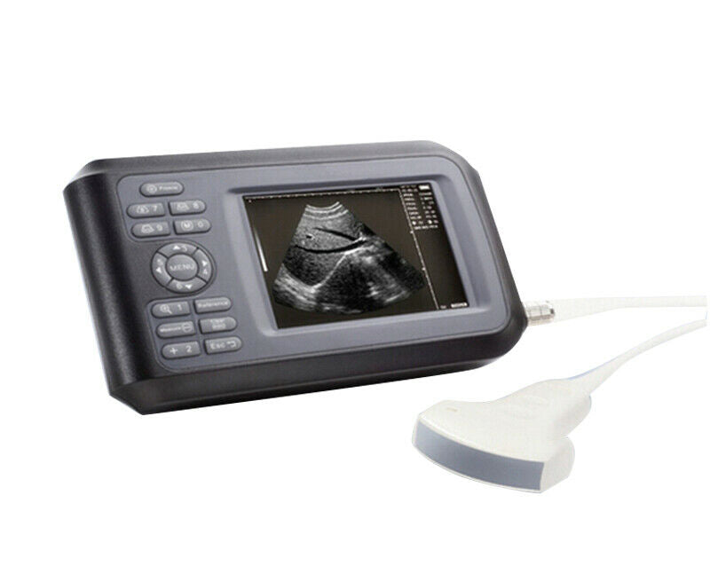 USA Handheld Ultrasound Scanner Machine 3.5mhz Convex Probe For Human W Case DIAGNOSTIC ULTRASOUND MACHINES FOR SALE