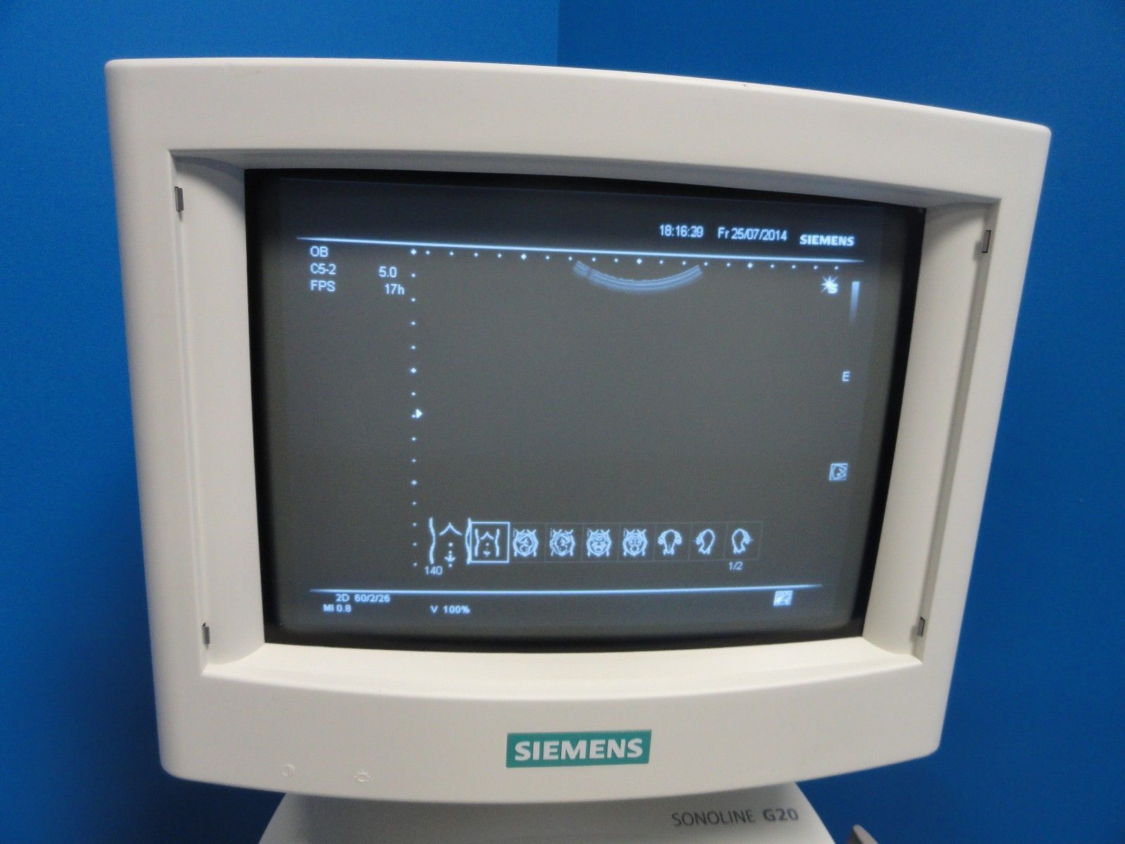 2005 Siemens Sonoline G20 Ultrasound W/ C5-2 Convex Transducer & Printer (6937) DIAGNOSTIC ULTRASOUND MACHINES FOR SALE