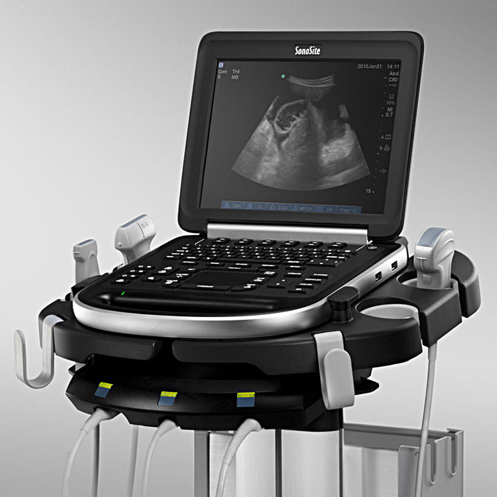 SonoSite Edge Ultrasound System Portable Machine with L38xi Vascular Transducer DIAGNOSTIC ULTRASOUND MACHINES FOR SALE