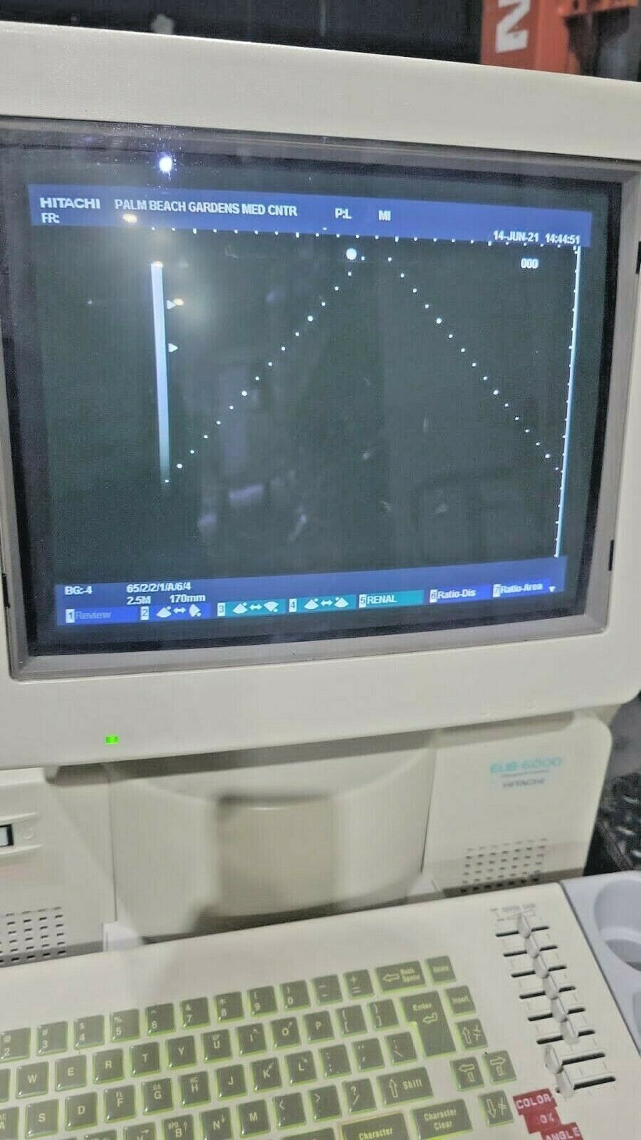 HITACHI Ultrasound eub 6000 DIAGNOSTIC ULTRASOUND MACHINES FOR SALE