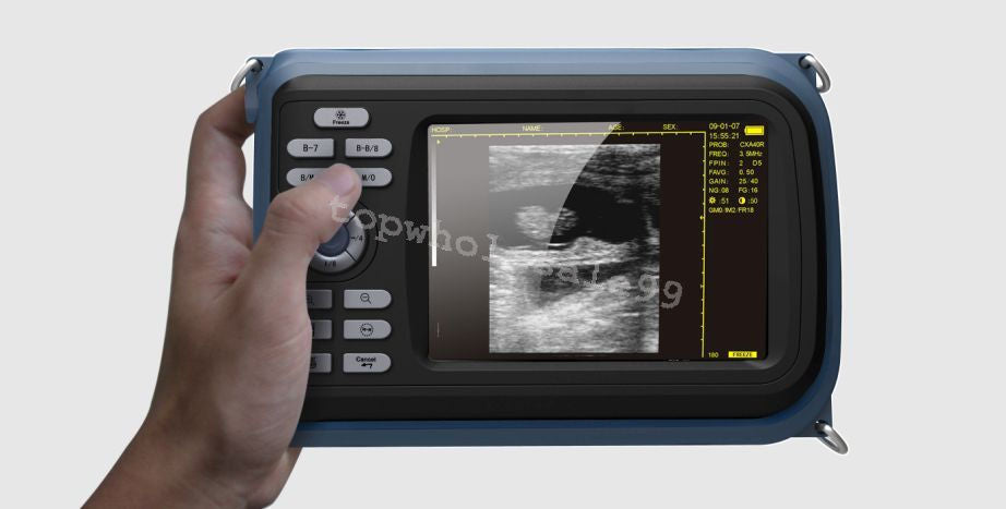 5” Pocket Veterinary Digital Ultrasound Scanner Machine+4.0 MHz Rectal Probe CE DIAGNOSTIC ULTRASOUND MACHINES FOR SALE