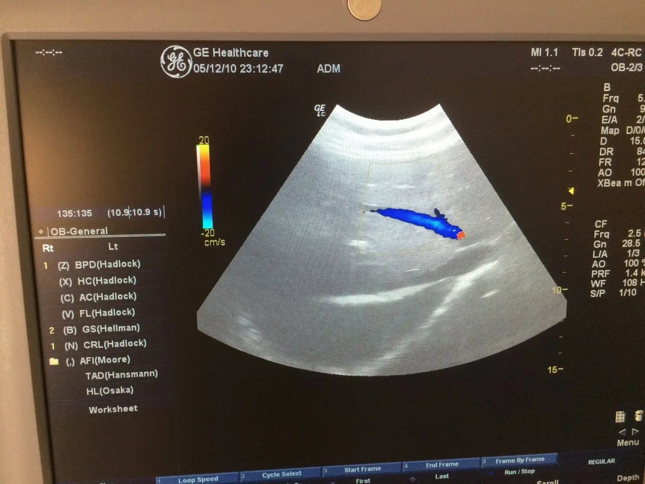 GE Ultrasound transducer probe convex 4CRC DIAGNOSTIC ULTRASOUND MACHINES FOR SALE
