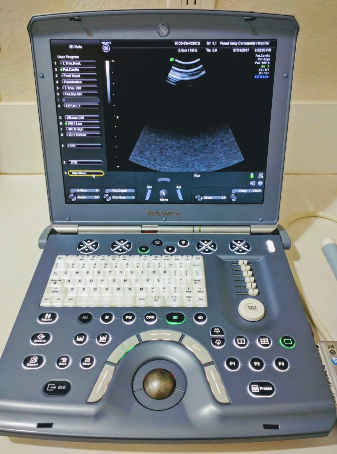 GE VOLUSON E BT08 3D/4D W/2 PROBES ULTRASOUND SYSTEM DIAGNOSTIC ULTRASOUND MACHINES FOR SALE