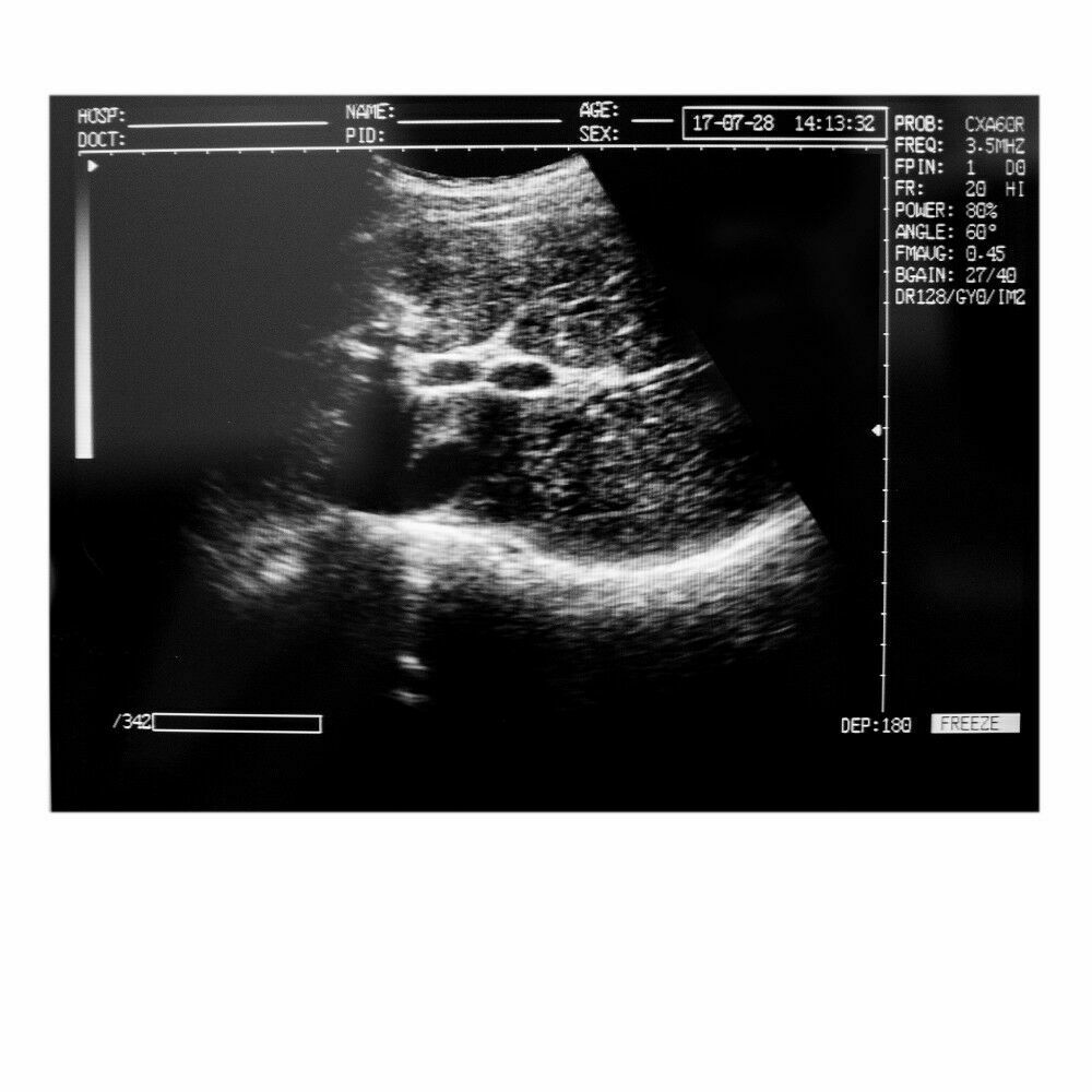 Portable Medical Laptop Diagnostic Ultrasound Scanner 3.5 Convex probe+Free 3D DIAGNOSTIC ULTRASOUND MACHINES FOR SALE