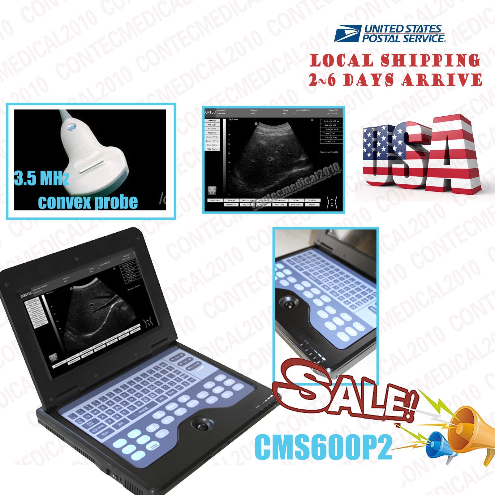 USA Ship Smart Laptop Ultrasound Scanner Diagnostic System with 3.5 convex probe DIAGNOSTIC ULTRASOUND MACHINES FOR SALE