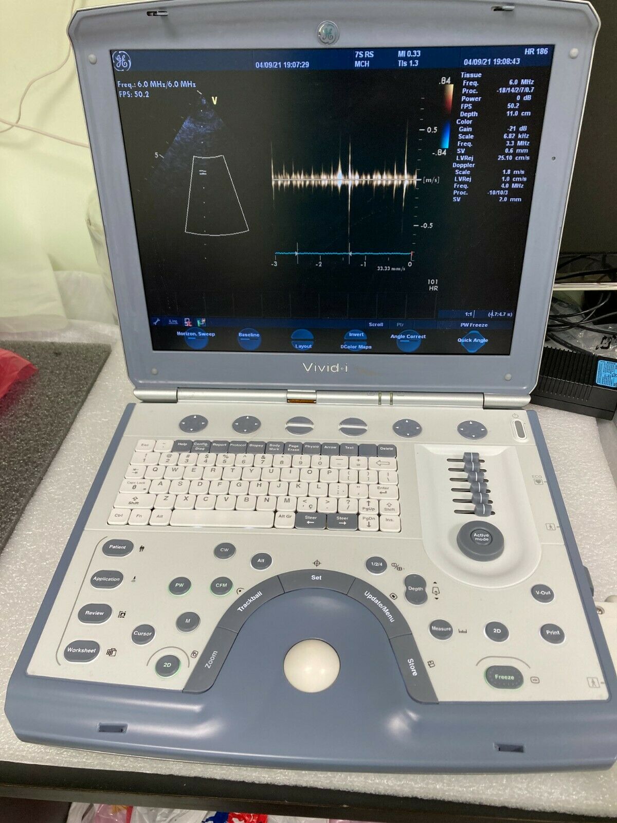 GE VIVID I BTO6 PORTABLE ULTRASOUND MACHINE WITH 3 PROBES and Cart. DIAGNOSTIC ULTRASOUND MACHINES FOR SALE