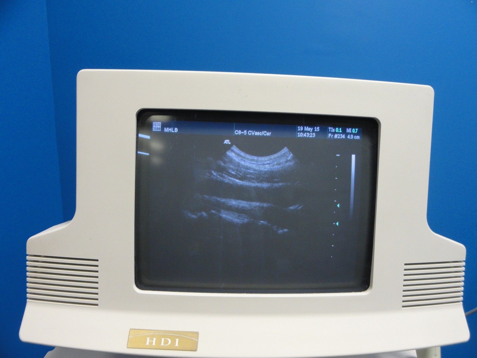 ATL C8-5 14R Micro-Convex Pediatric Small Parts Vascular MSK OB Probe (8890 ) DIAGNOSTIC ULTRASOUND MACHINES FOR SALE