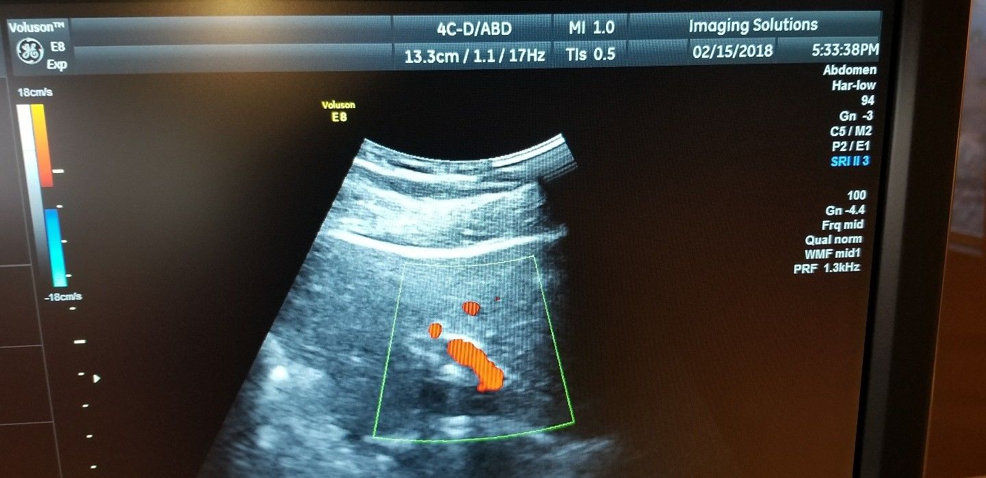 GE Health Care  4C-D Ultrasound Transducer