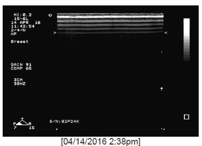 a black and white ultrasound photo 