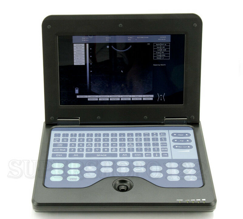 Digital Portable Notebook Laptop Ultrasound machine Scanner system CONVEX PROBE DIAGNOSTIC ULTRASOUND MACHINES FOR SALE