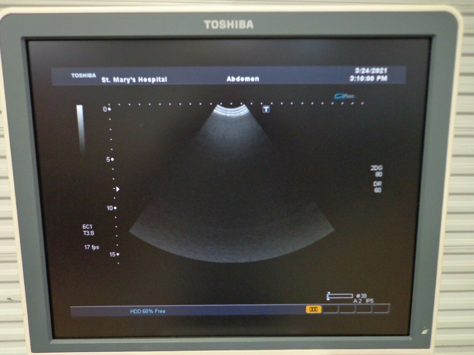 Toshiba Aplio XG iStyle Ultrasound PVT-382BT PVT-661VT PVT-375BT PLT-1204AT DIAGNOSTIC ULTRASOUND MACHINES FOR SALE