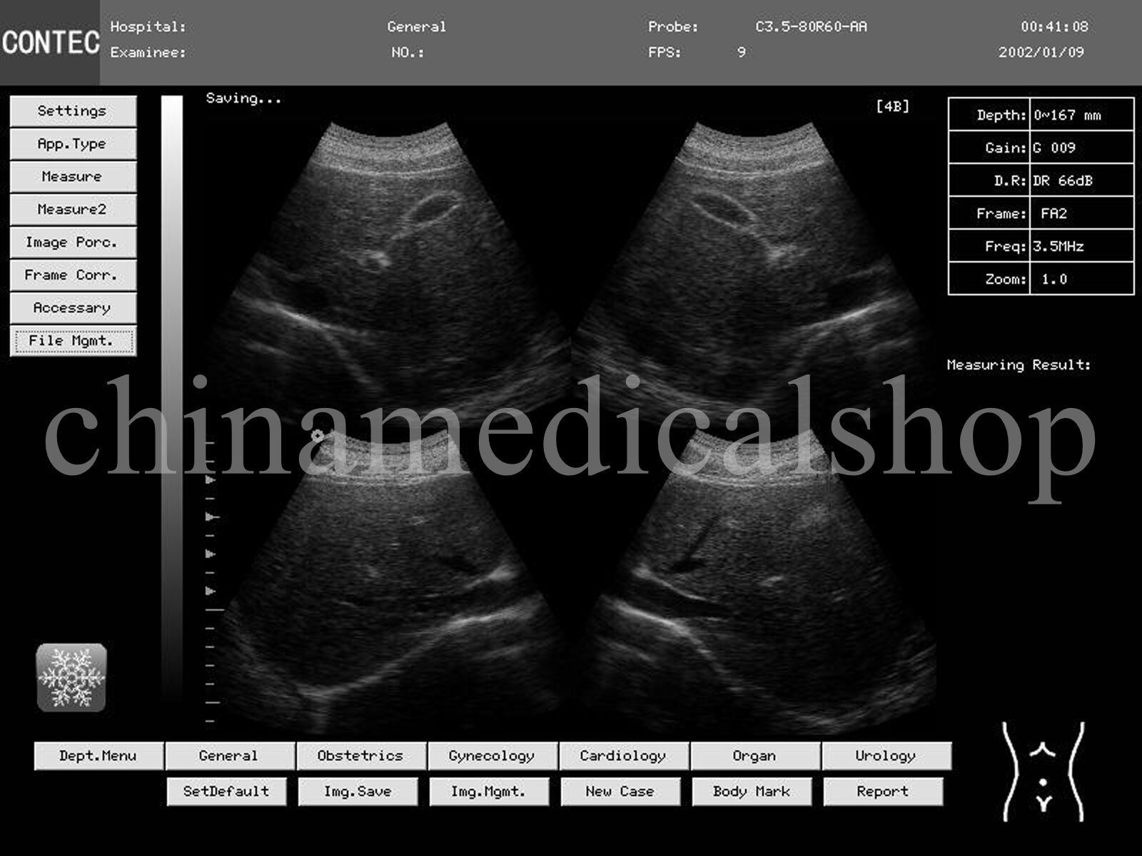 With Convex &Cardiac Sensors Digital Ultrasound Scanner Ultrasonic Machine USA DIAGNOSTIC ULTRASOUND MACHINES FOR SALE