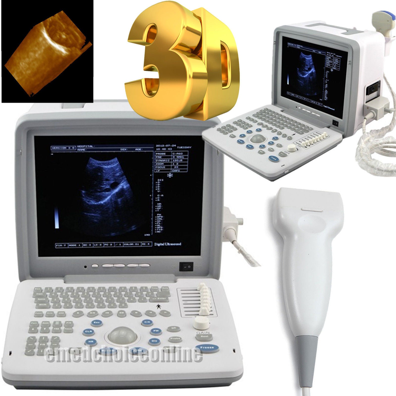 Top selling Medical Ultrasound  Scanner System + linear Probe + 3D system DIAGNOSTIC ULTRASOUND MACHINES FOR SALE