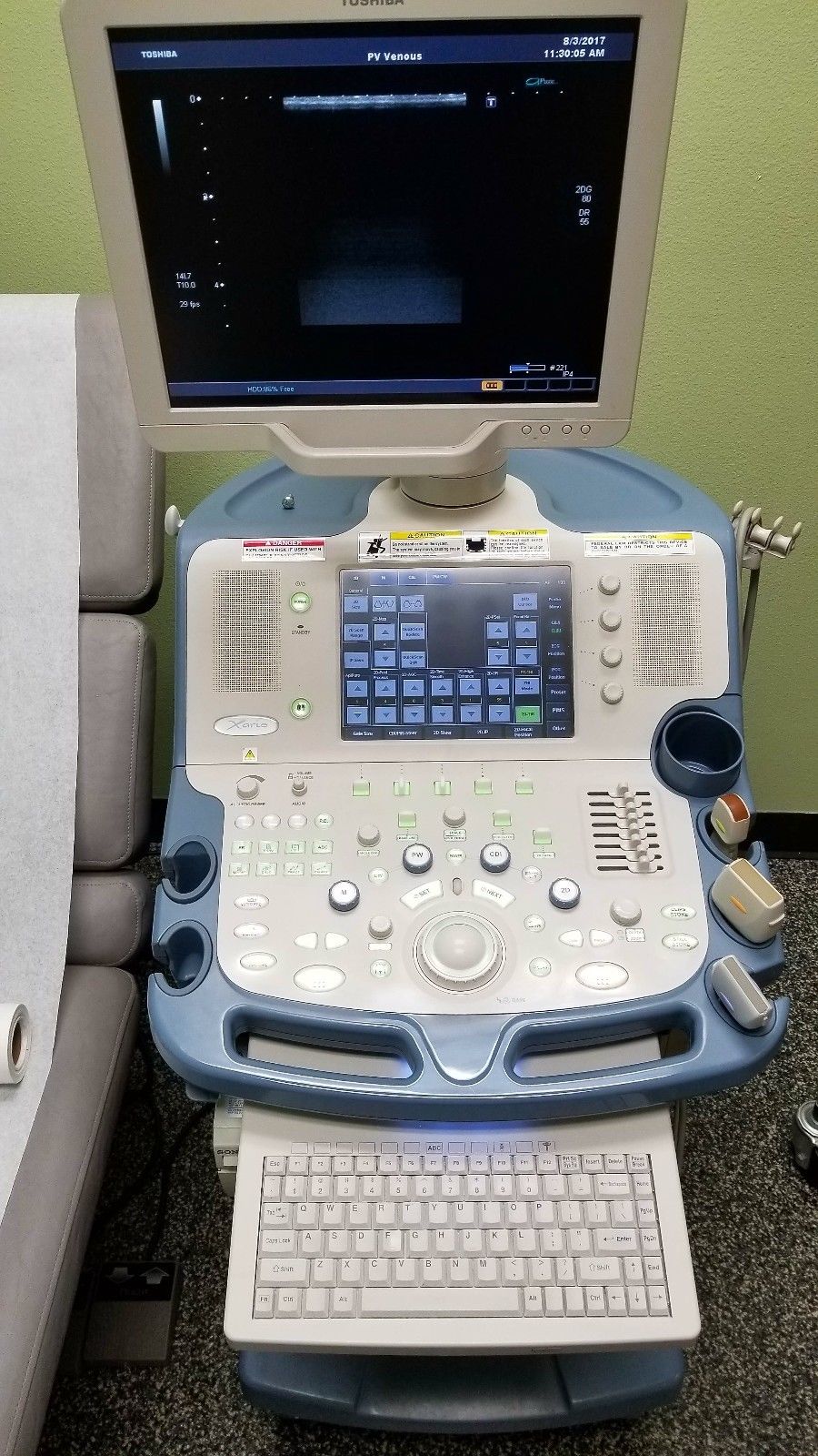 Toshiba Xario SSA-660A Ultrasound with THREE Probes – Excellent Condition!!! DIAGNOSTIC ULTRASOUND MACHINES FOR SALE