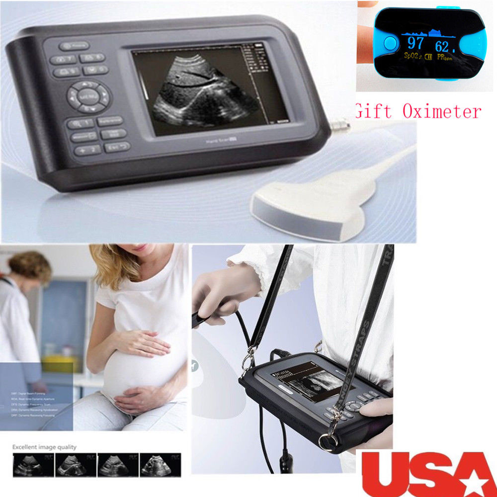 US Ship Diagnostic Ultrasound Scanner Machine Convex Probe+Pulse Oximeter Clinic DIAGNOSTIC ULTRASOUND MACHINES FOR SALE