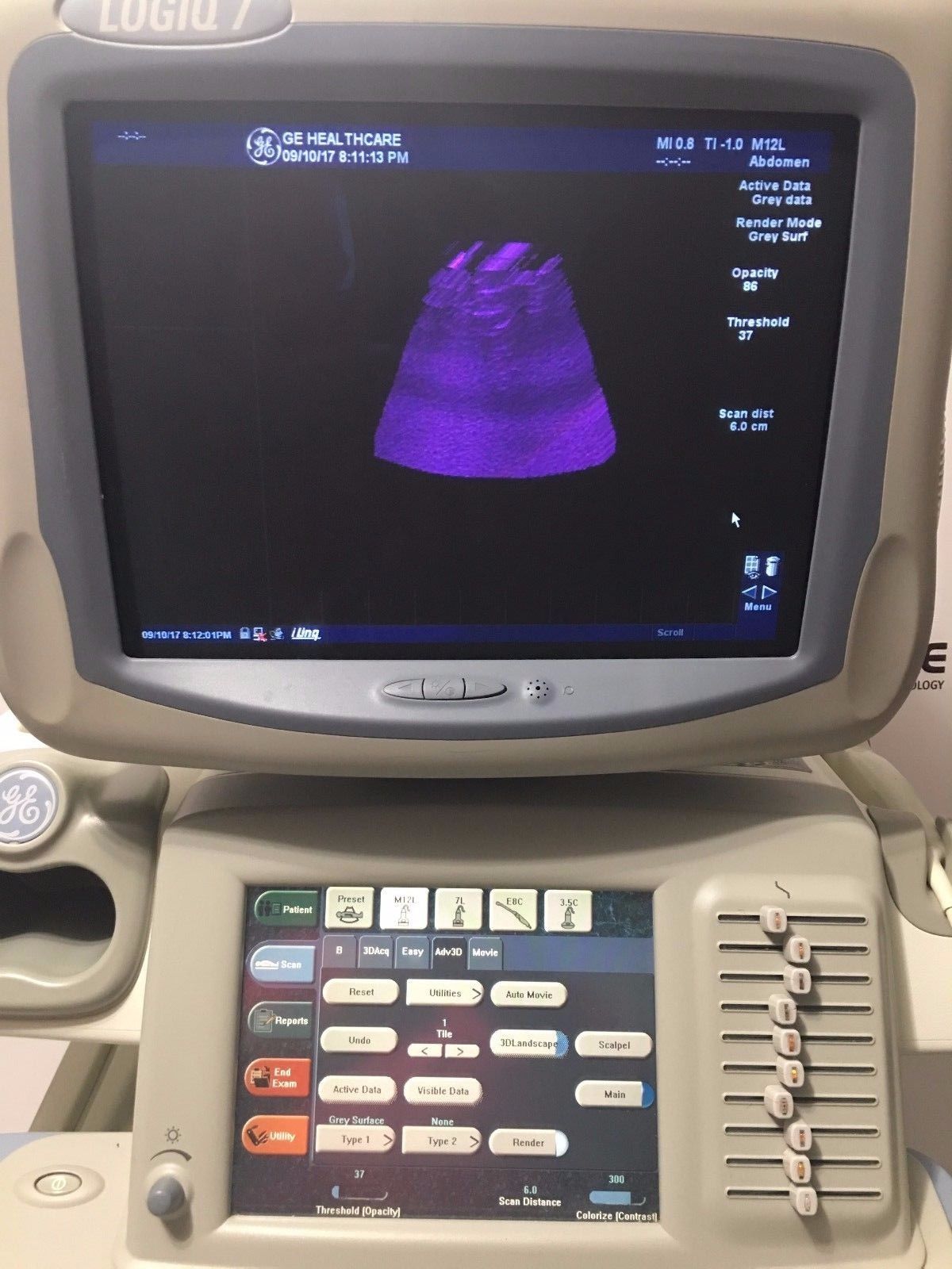 GE Logiq 9 Ultrasound System with 3.5C, E8C, 7L, 10L, and M12L  Transducers DIAGNOSTIC ULTRASOUND MACHINES FOR SALE