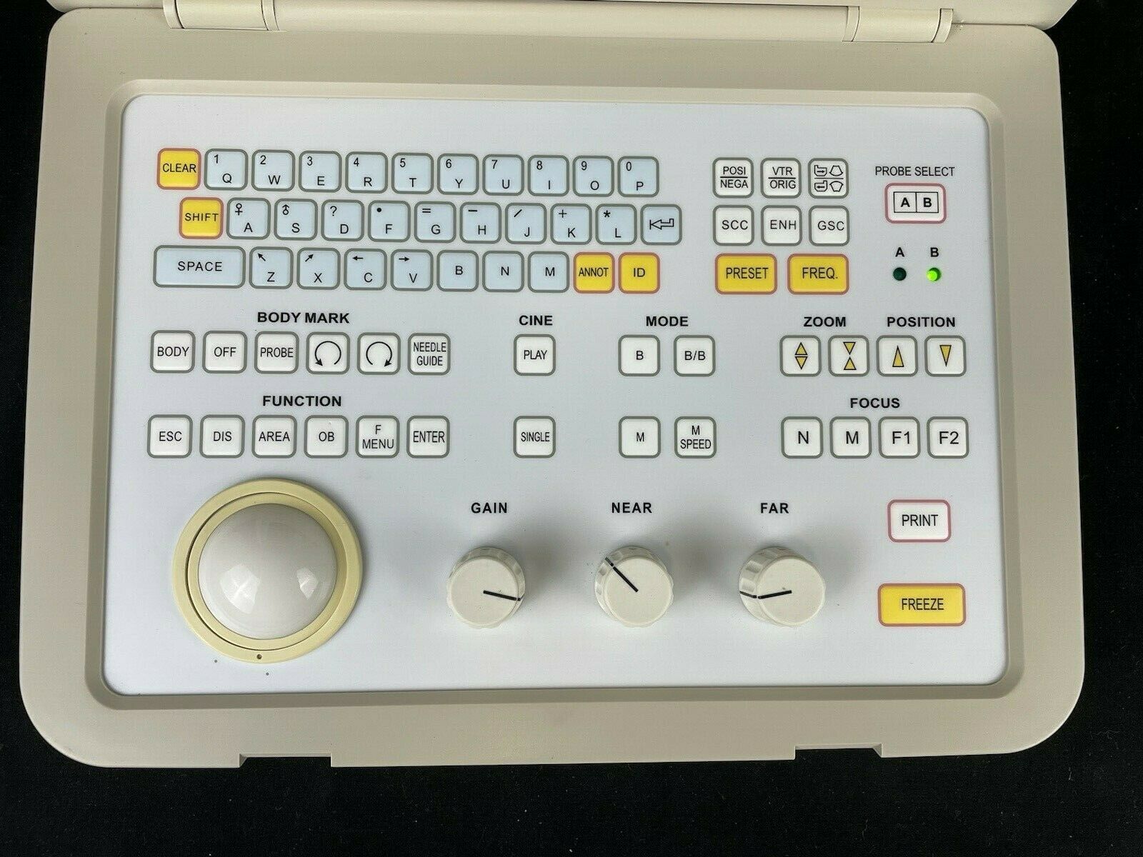 SIUI CTS-485 Ultrasonic Diagnostic Instrument Portable Ultrasound Machine DIAGNOSTIC ULTRASOUND MACHINES FOR SALE