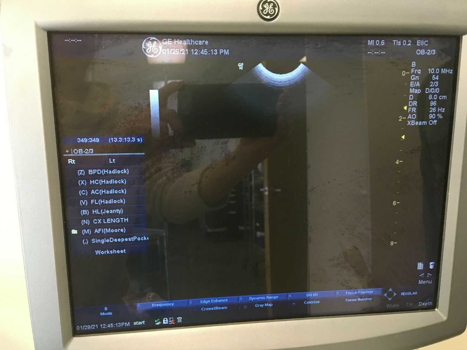 GE LOGIQ P3 Ultrasound R1.0.4 W/2 Probes 4C 2401359 E8C 2297883 Sony Printer DIAGNOSTIC ULTRASOUND MACHINES FOR SALE