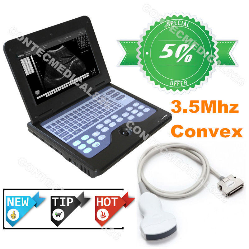 CE Portable Ultrasound Scanner Laptop Machine Diagnostic System Optional 4 Probe DIAGNOSTIC ULTRASOUND MACHINES FOR SALE