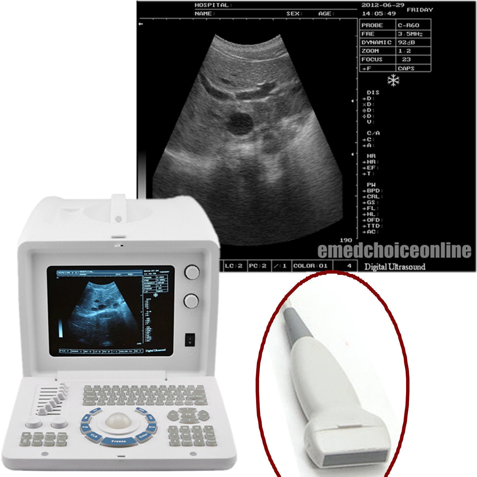 Top 3D Ultrasound Scanner SVGA 7.5 Linear Probe external 3D version USB port DIAGNOSTIC ULTRASOUND MACHINES FOR SALE