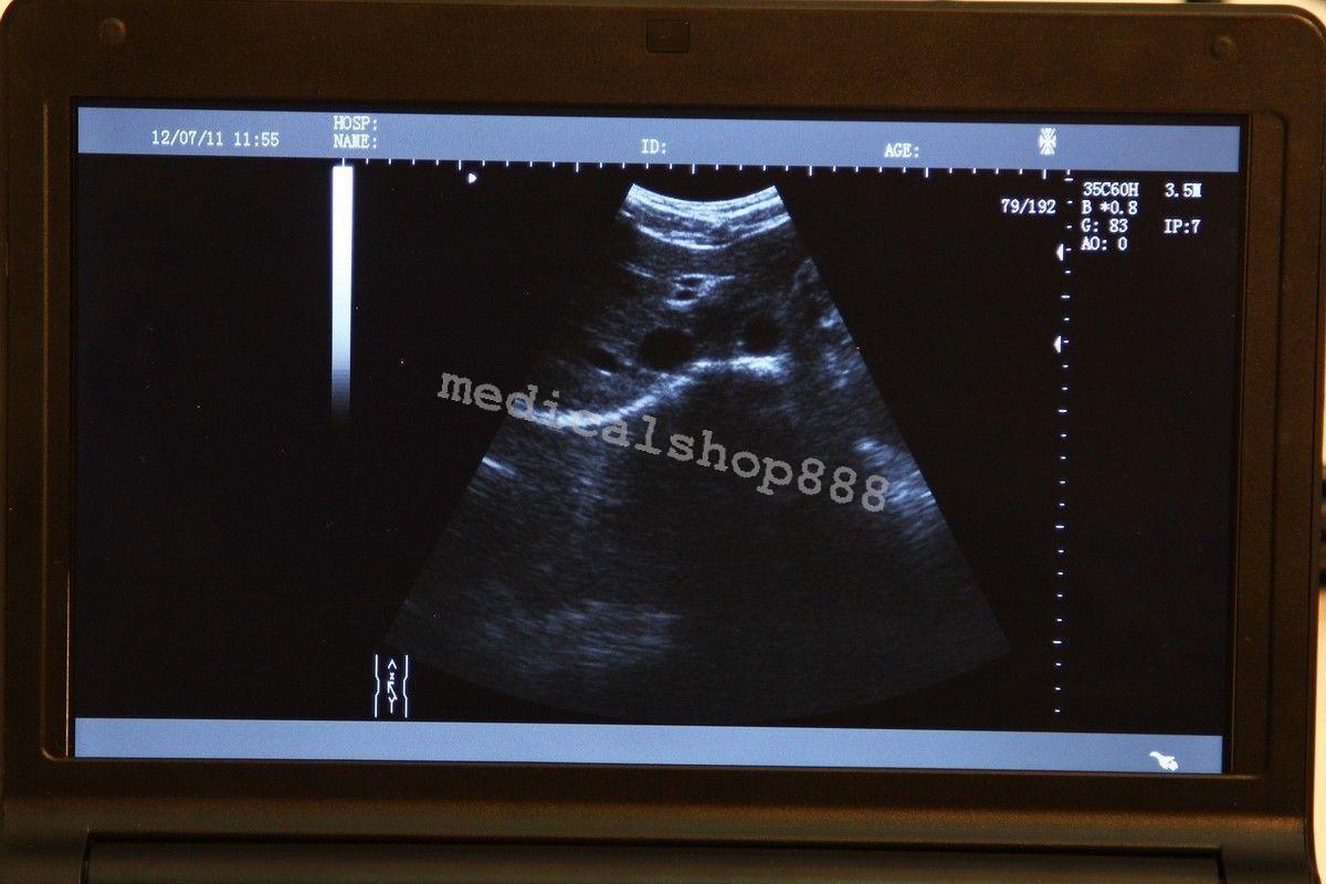 Sale! 10Inch  Laptop Ultrasound Scanner with linear probe 3D Ultrasound Device 190891478627 DIAGNOSTIC ULTRASOUND MACHINES FOR SALE