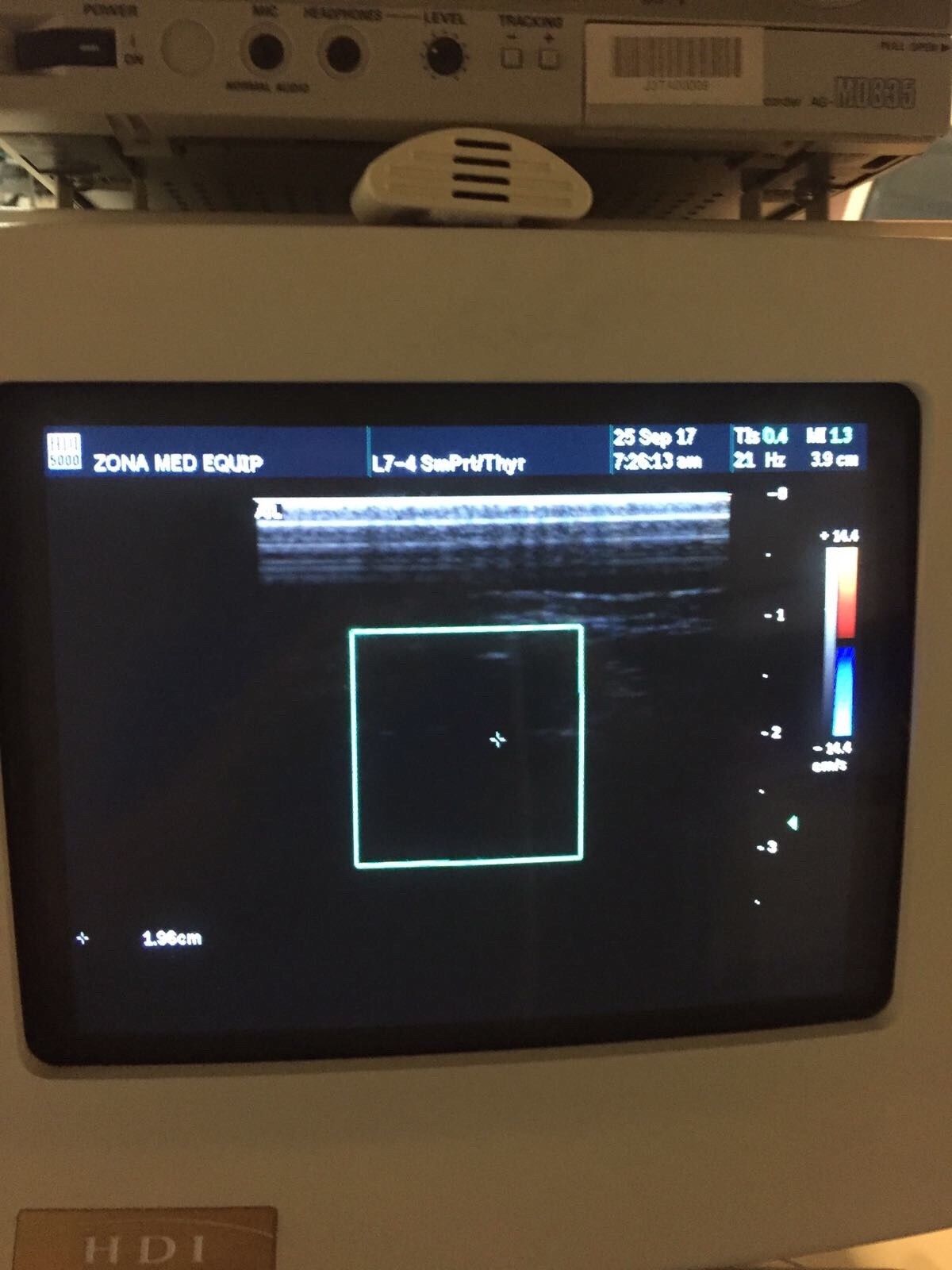 ATL Philips HDI 5000 SonoCT Ultrasound Machine with 2 probes DIAGNOSTIC ULTRASOUND MACHINES FOR SALE