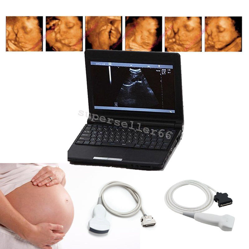 Digital LCD Ultrasound Scanner B Ultrasonic Machine,Convex Probe ,Linear Probe DIAGNOSTIC ULTRASOUND MACHINES FOR SALE