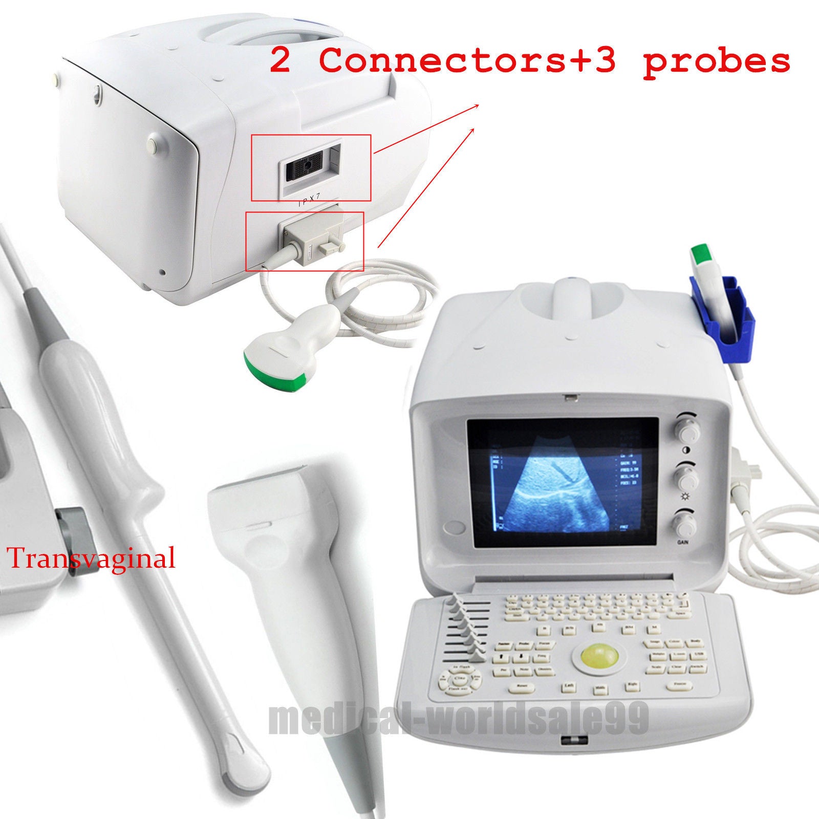 Ultrasound Device Ultrasound Scanner Machine Convex/Linear /Vaginal 3 Probes 3D 190891229403 DIAGNOSTIC ULTRASOUND MACHINES FOR SALE