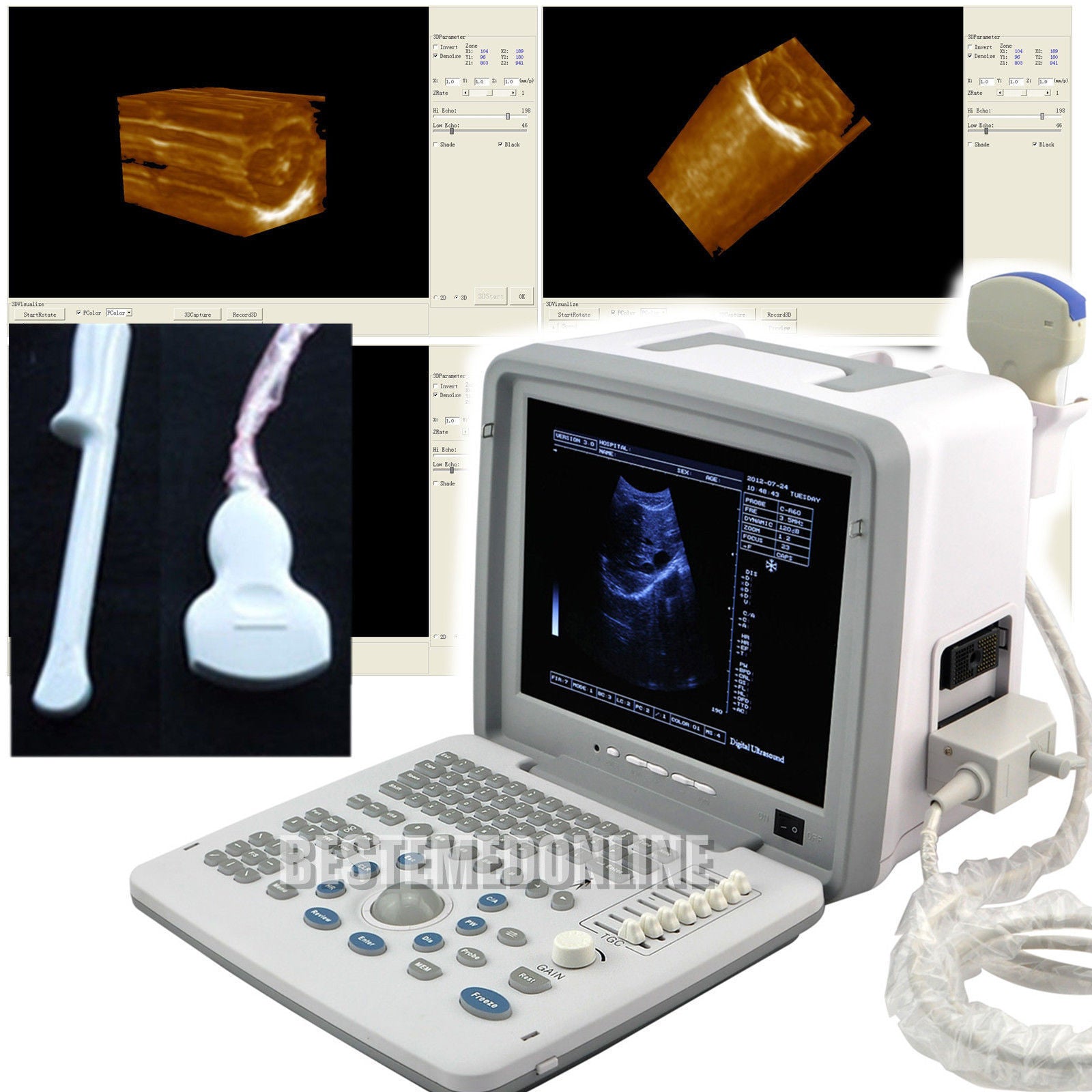 12" LED Full Digital Portable Ultrasound Scanner +3.5M Convex +7.5M Linear probe 190891974327 DIAGNOSTIC ULTRASOUND MACHINES FOR SALE