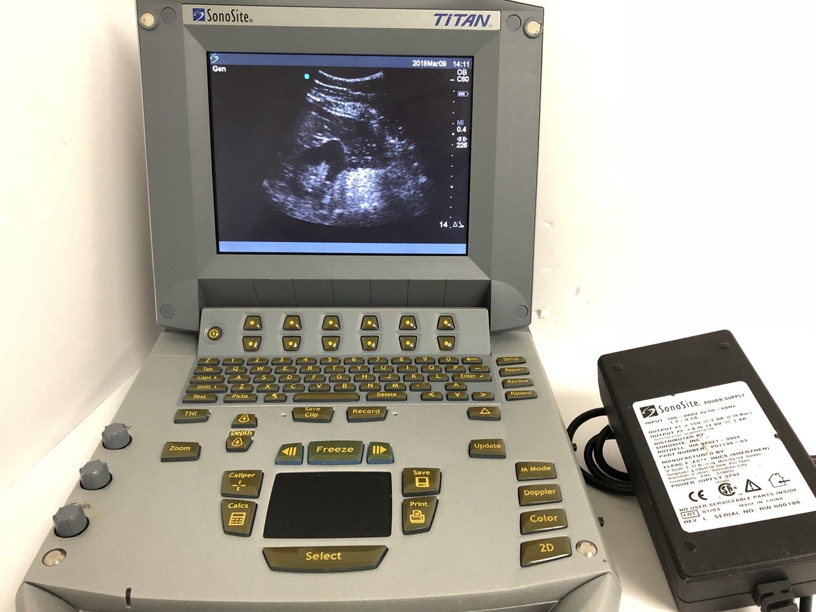 SONOSITE TITAN Ultrasound With C60/5-2 Convex Array Probe And Power Supply DIAGNOSTIC ULTRASOUND MACHINES FOR SALE